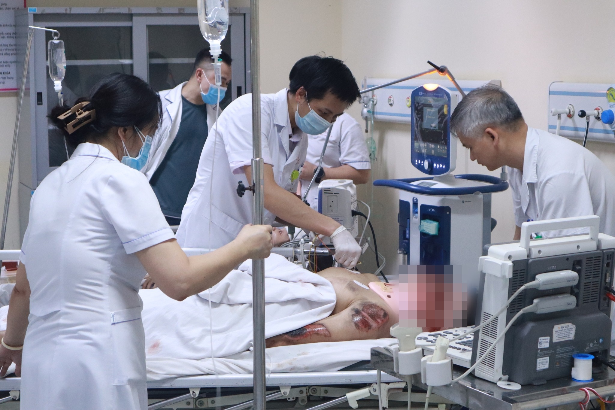 Ba nguoi bi thuong rat nang trong vu oto tong 17 xe may o Ha Noi hinh anh