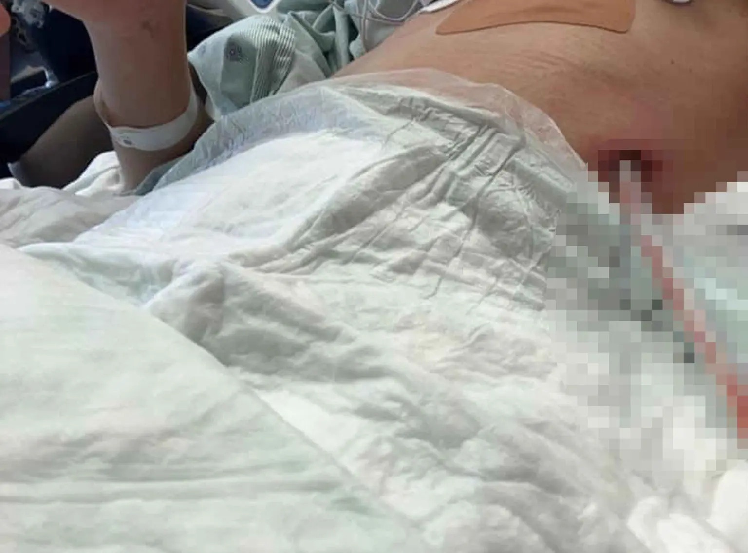 tran ki mang phoi anh 1