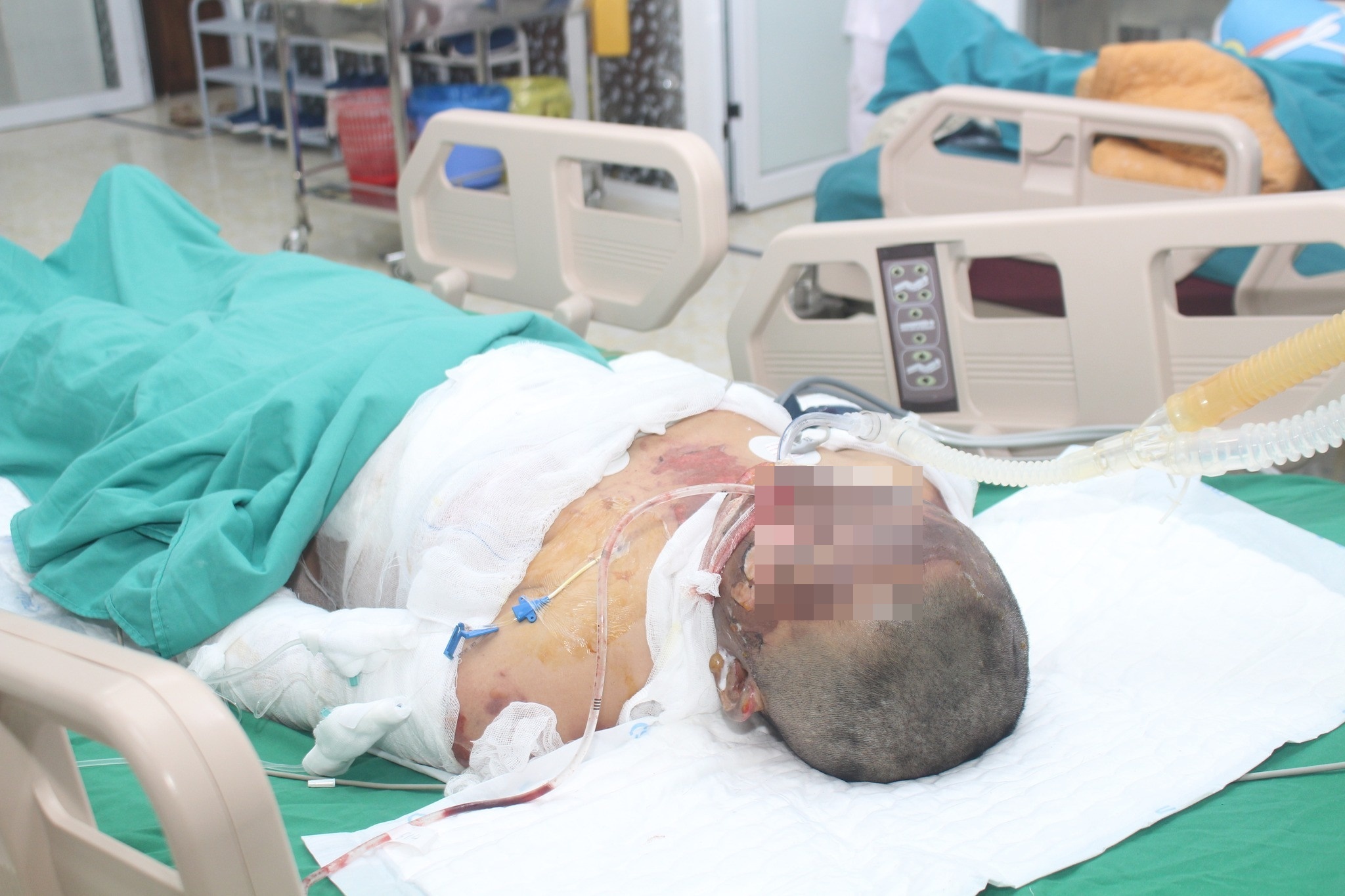 Hai me con bi bong nang khi di dot nuong hinh anh