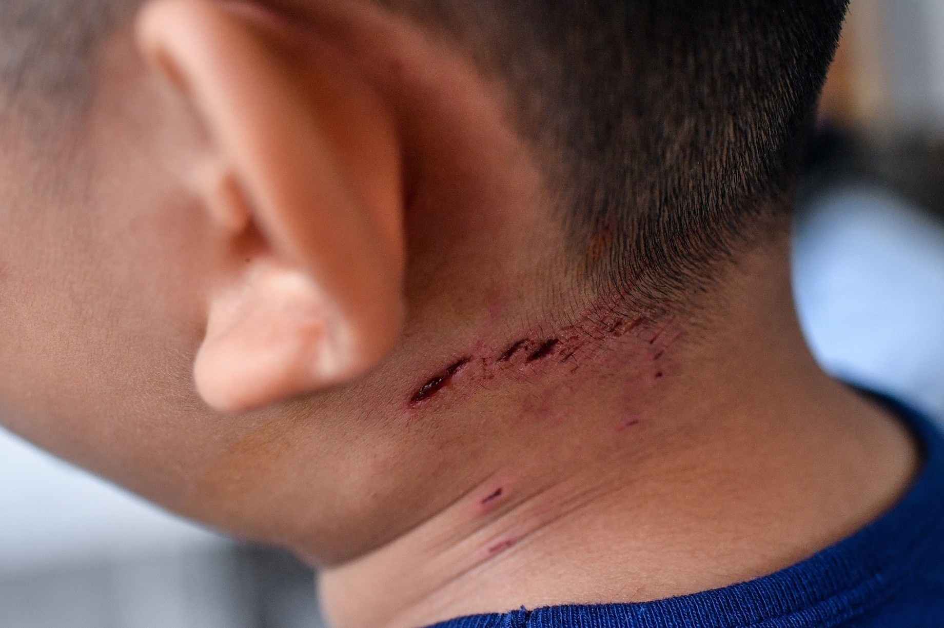 kiem soat benh dai anh 2