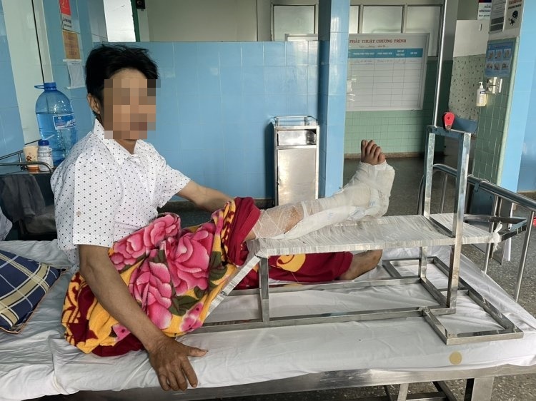 Noi lien ban chan bi may cat co cat dut gan lia hinh anh