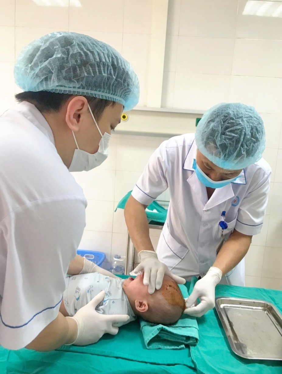 vật nhọn đâm đầu ảnh 1 vat nhon dam dau anh 1