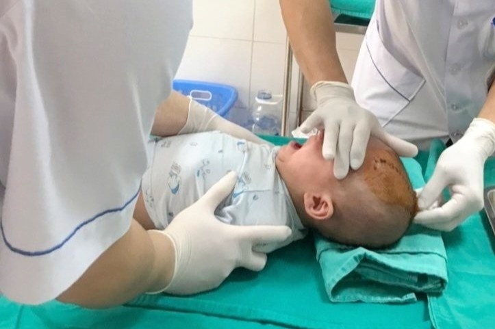 Be trai bi vat nhon dam vao thop hinh anh