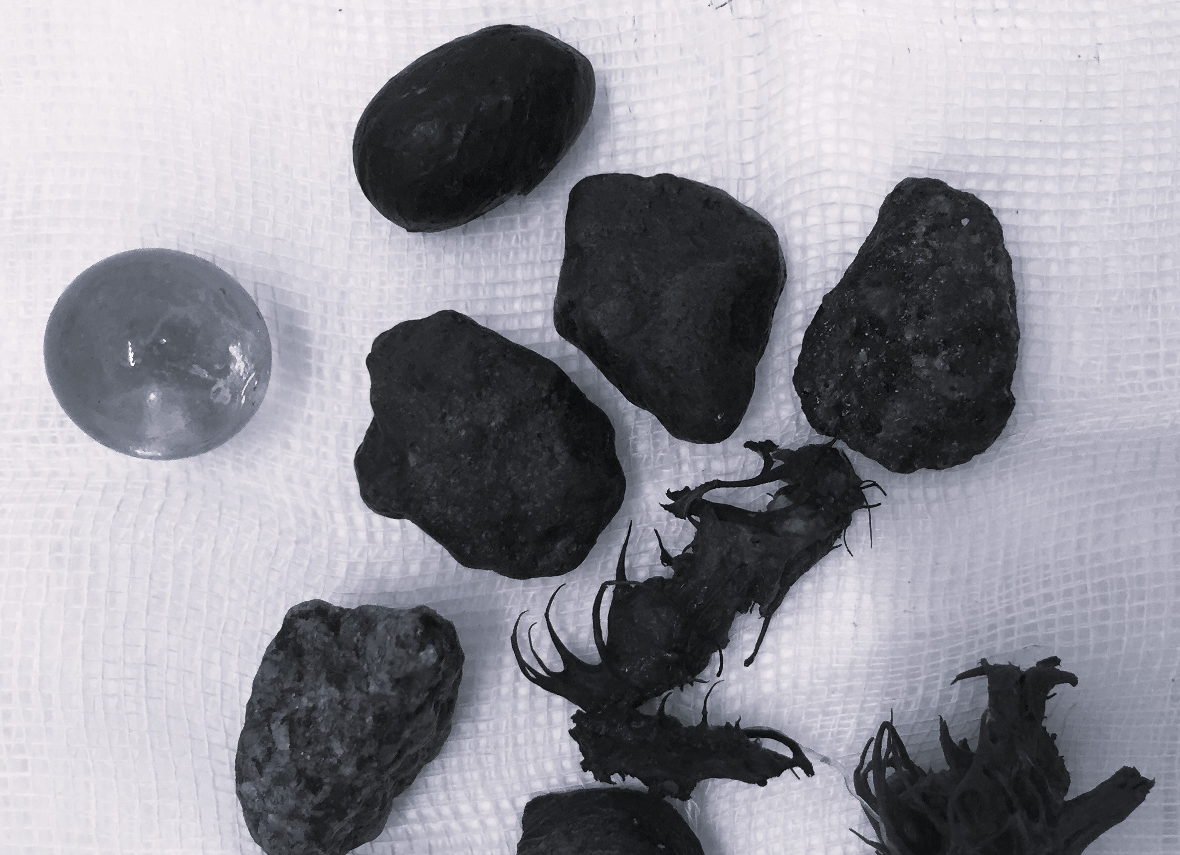 Bac si phat hien da day benh nhan nhu ‘dong rac hon don’ hinh anh