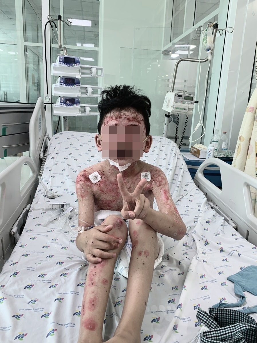 nhiễm trùng toàn thân ảnh 1 nhiem trung toan than anh 1