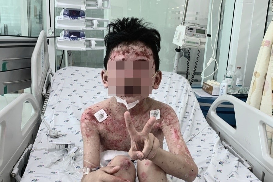 Phat hien mac benh hiem gap sau 2 ngay an cua hinh anh