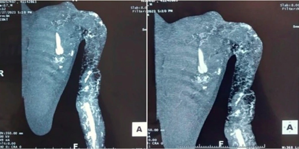 Can benh khien canh tay bien dang doi mau, ro nhu to ong hinh anh