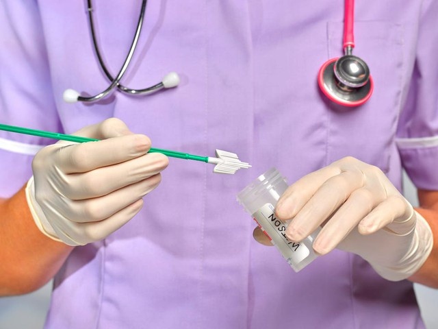 ung thu co tu cung anh 1