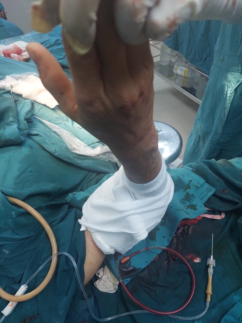 canh tay dut lia anh 1