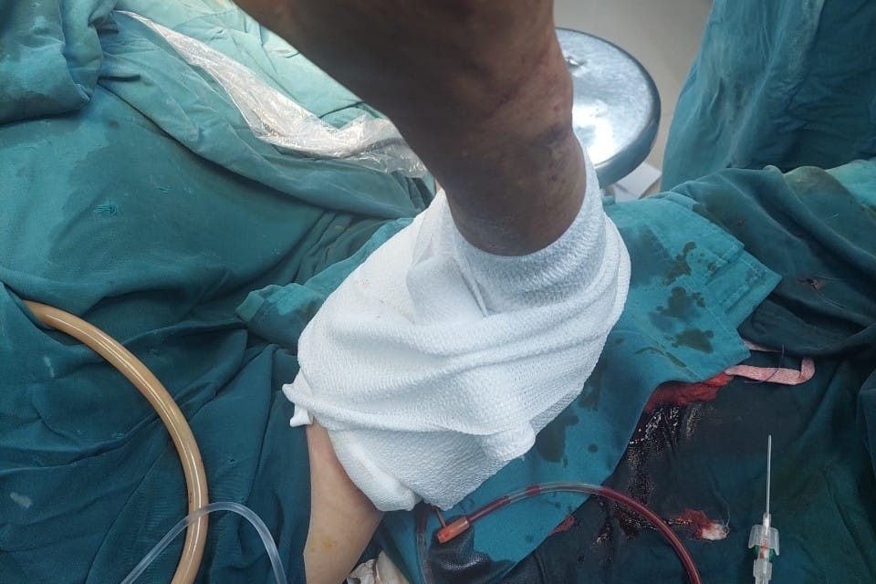 Noi lien canh tay dut lia do bi may cua cat hinh anh