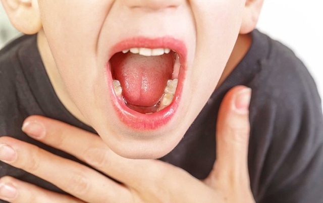 Viem amidan qua phat trong mua he o tre phai lam gi? hinh anh