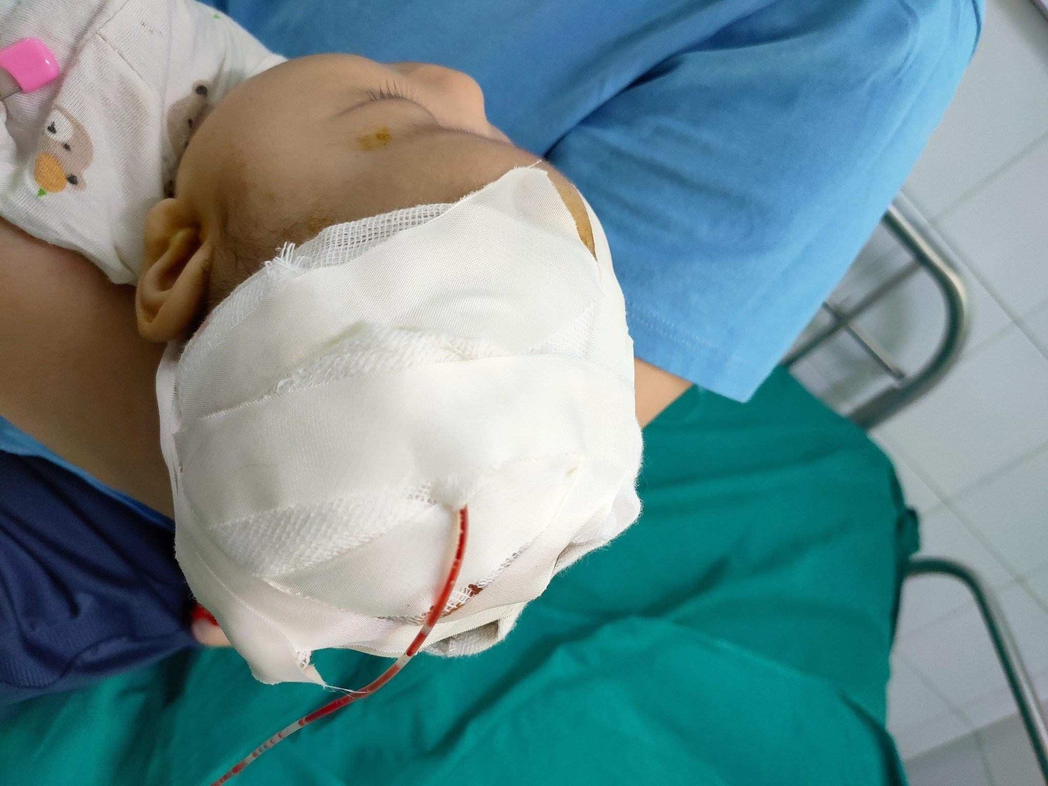 benh nhi 2, 5 thang anh 1