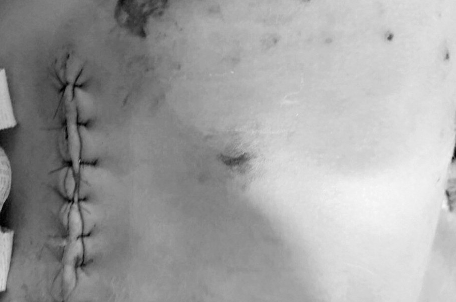 Be trai 3 tuoi bi cho bec gie can thung bung hinh anh