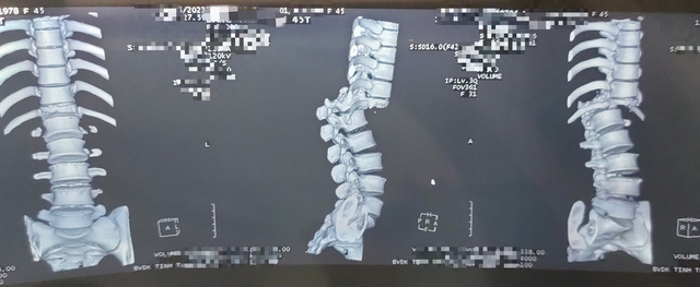 hai vai gay cot song anh 1