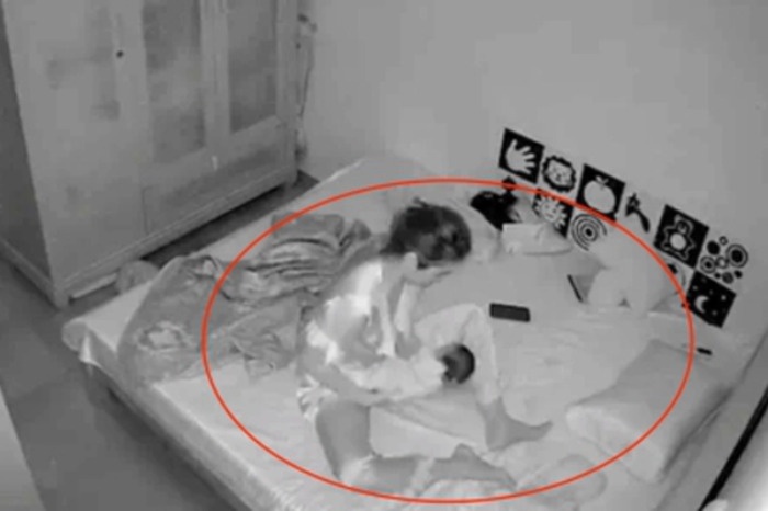 Bac si noi gi ve vu viec tre mot thang tuoi bi bao mau rung lac? hinh anh