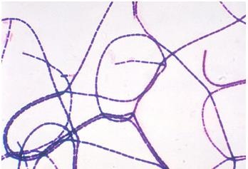 Ly do khien vi khuan than la mam benh chet nguoi hinh anh