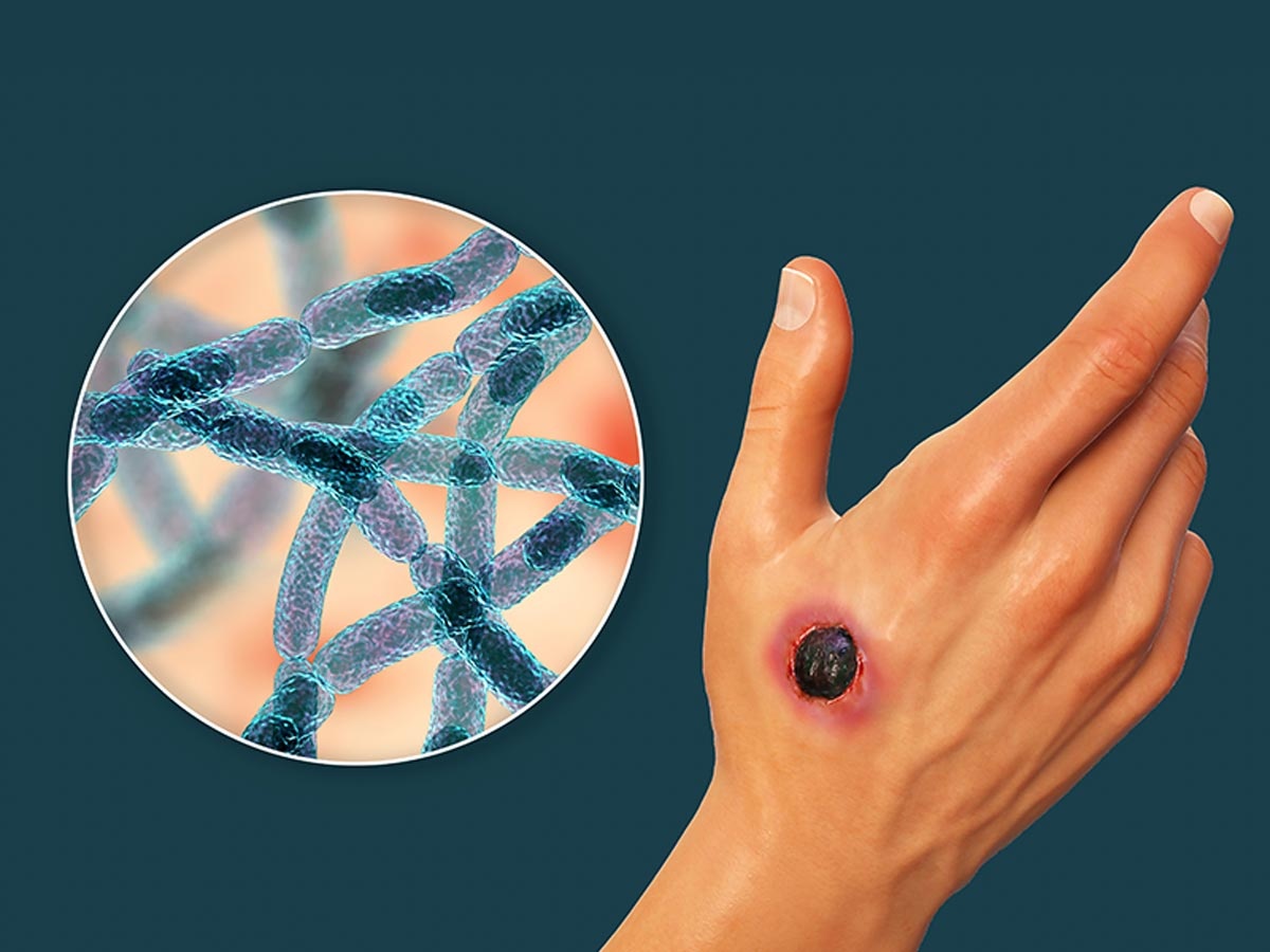 Can benh tu loai vi khuan duoc dung lam vu khi sinh hoc hinh anh