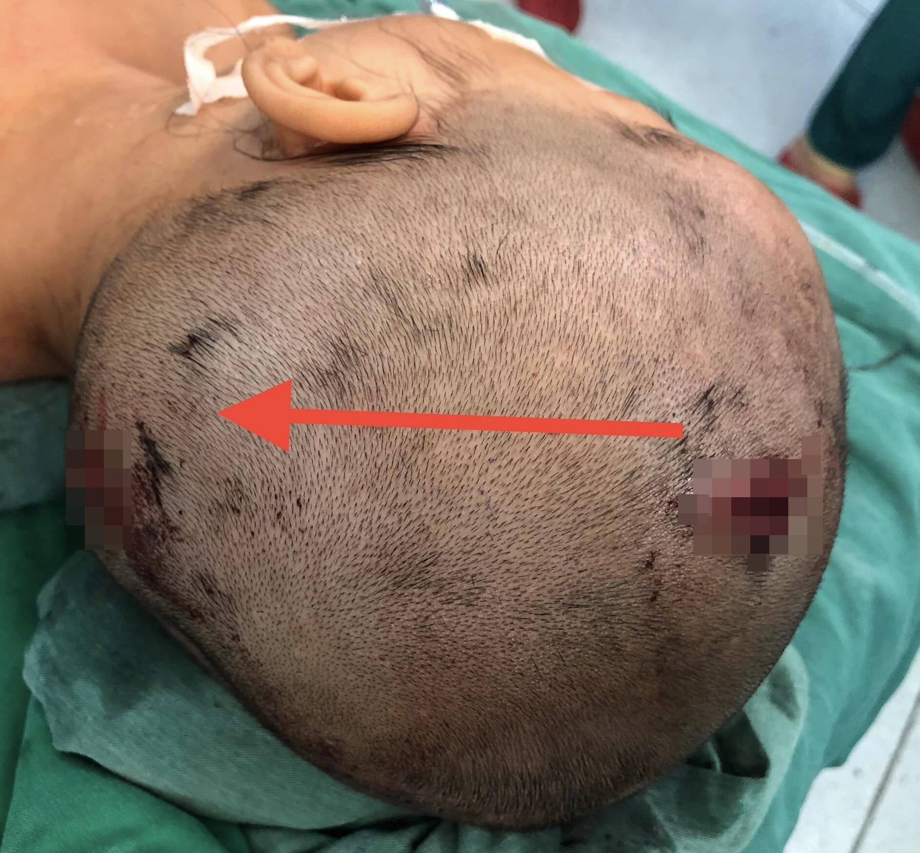 no binh gas minu anh 1