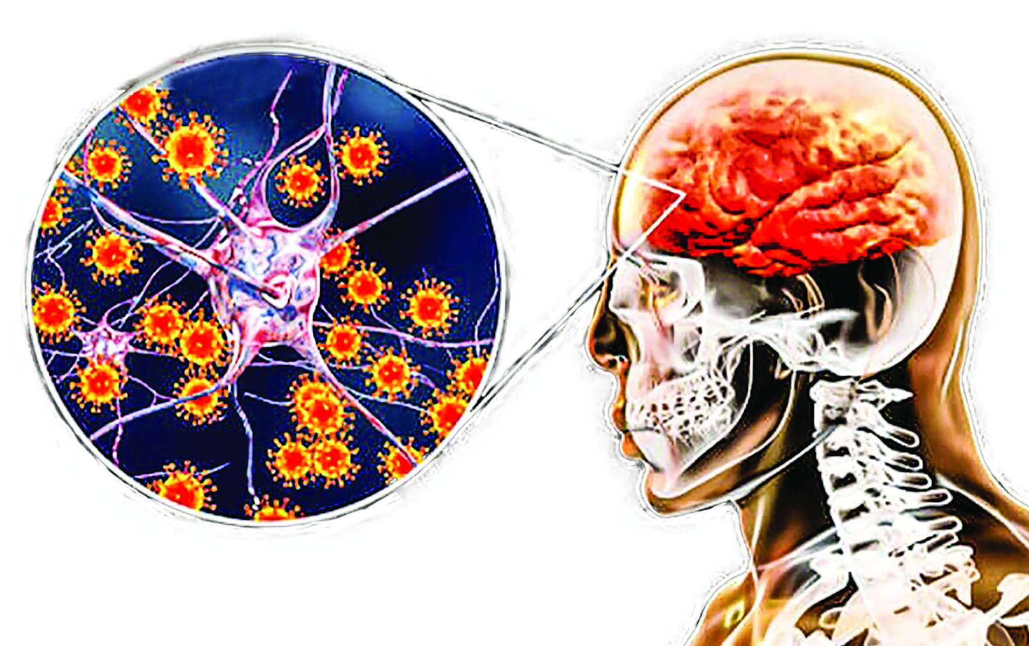 viem nao nhat ban anh 1