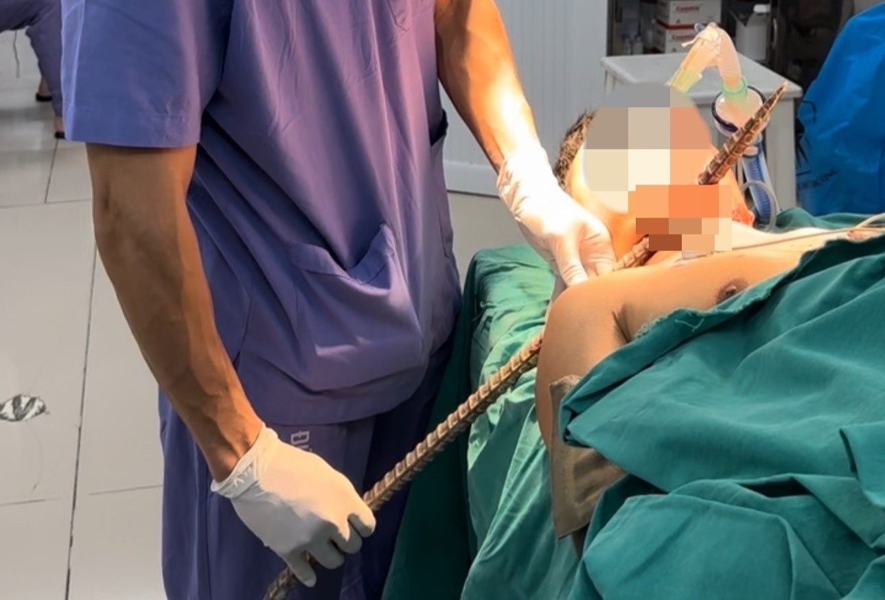 Nguoi dan ong bi xa beng dam xuyen co hinh anh