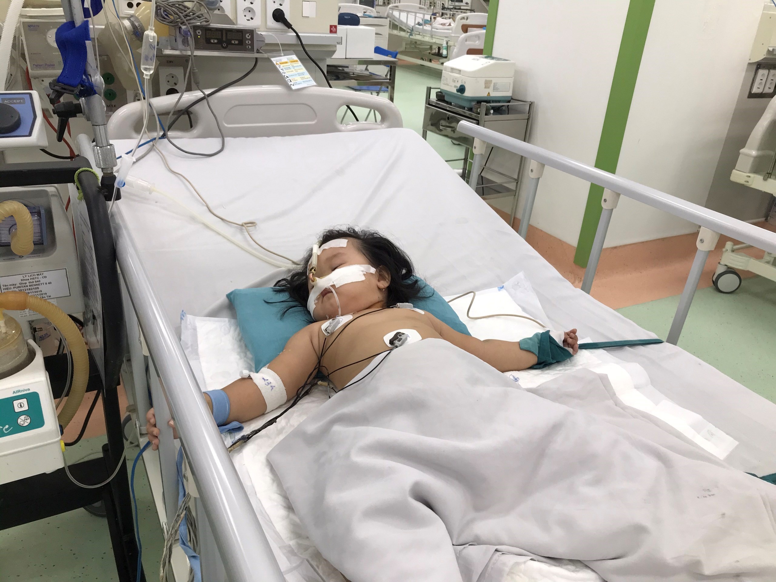 Benh nhi phai loc mau, tho may vi tay chan mieng hinh anh