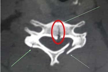 treo cay hai vai anh 1