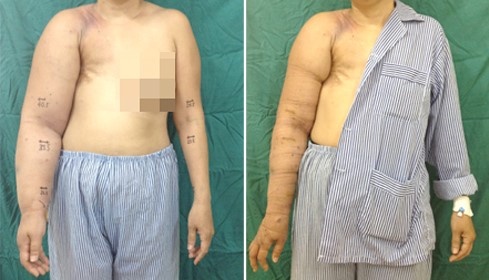 phù bạch mạch ảnh 1 phu bach mach anh 1