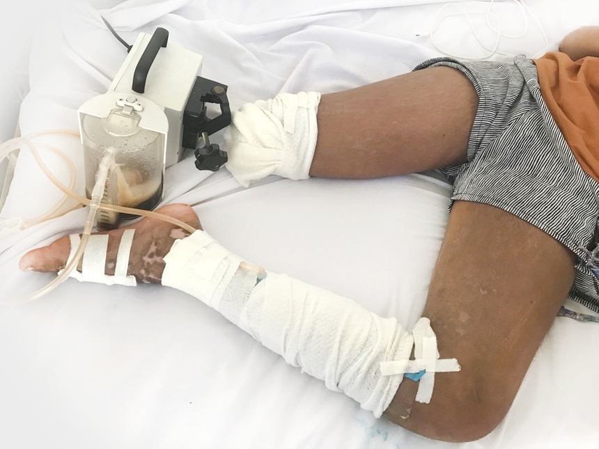 ran doc can nguoi anh 2