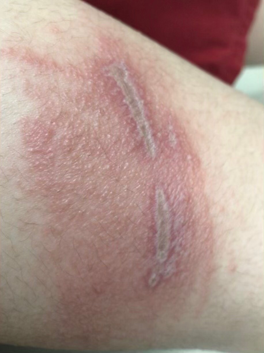 noc doc kien ba khoang anh 4