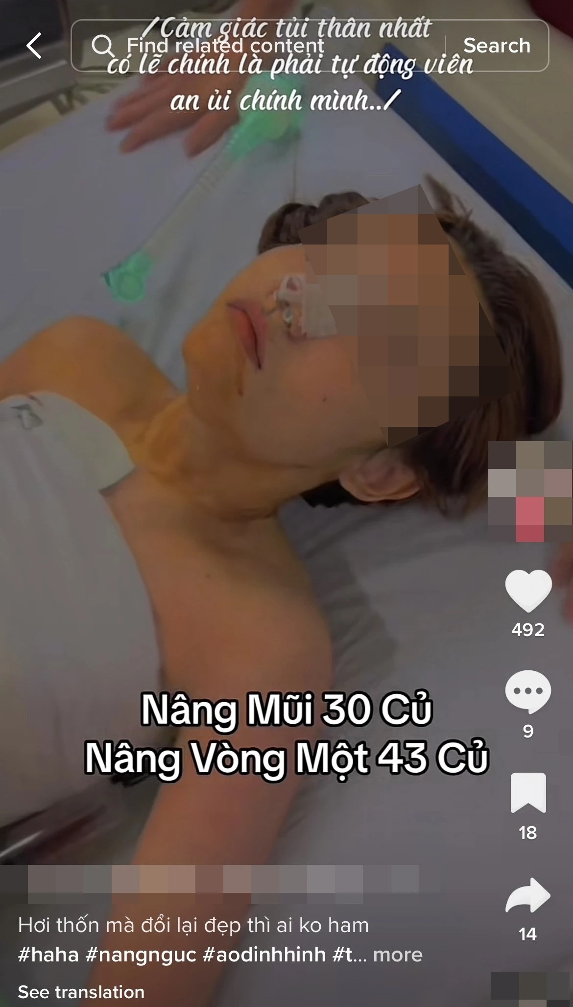 phau thuat tham my anh 1