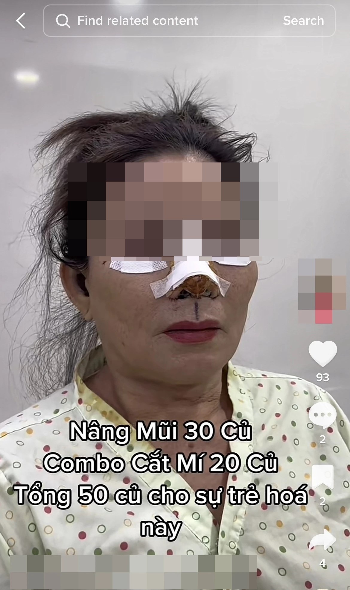 phau thuat tham my anh 2