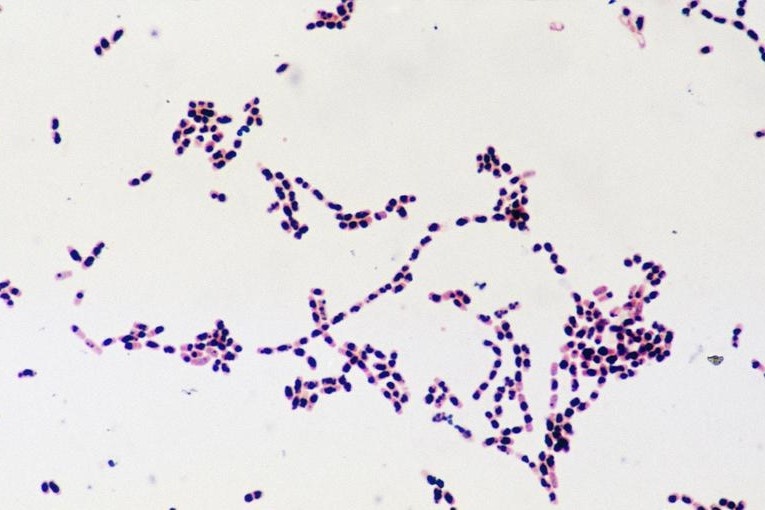 Bacillus Cereus anh 1