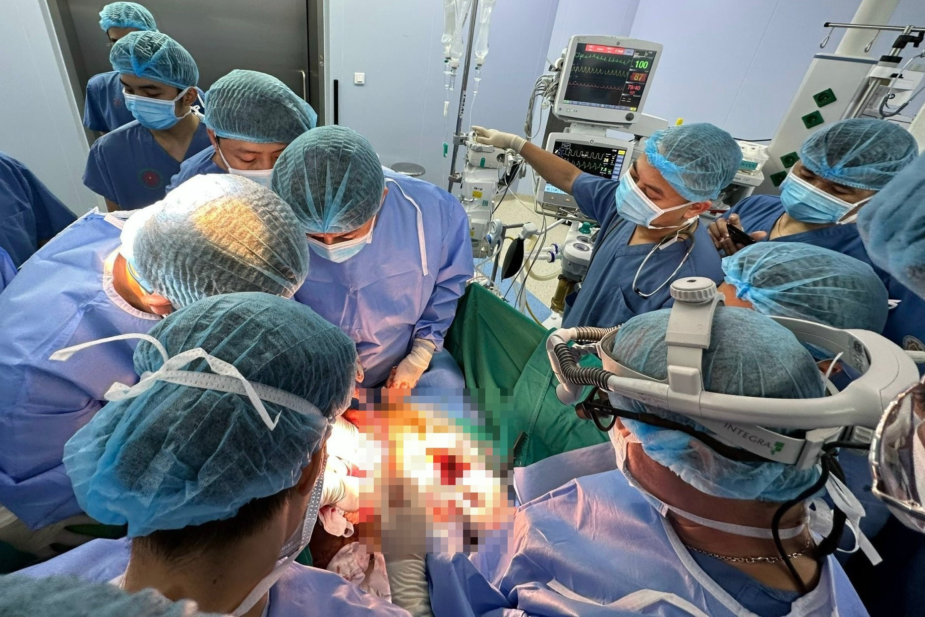 Cuu thanh nien bi thanh sat dai 1,7 m dam xuyen nguoi hinh anh