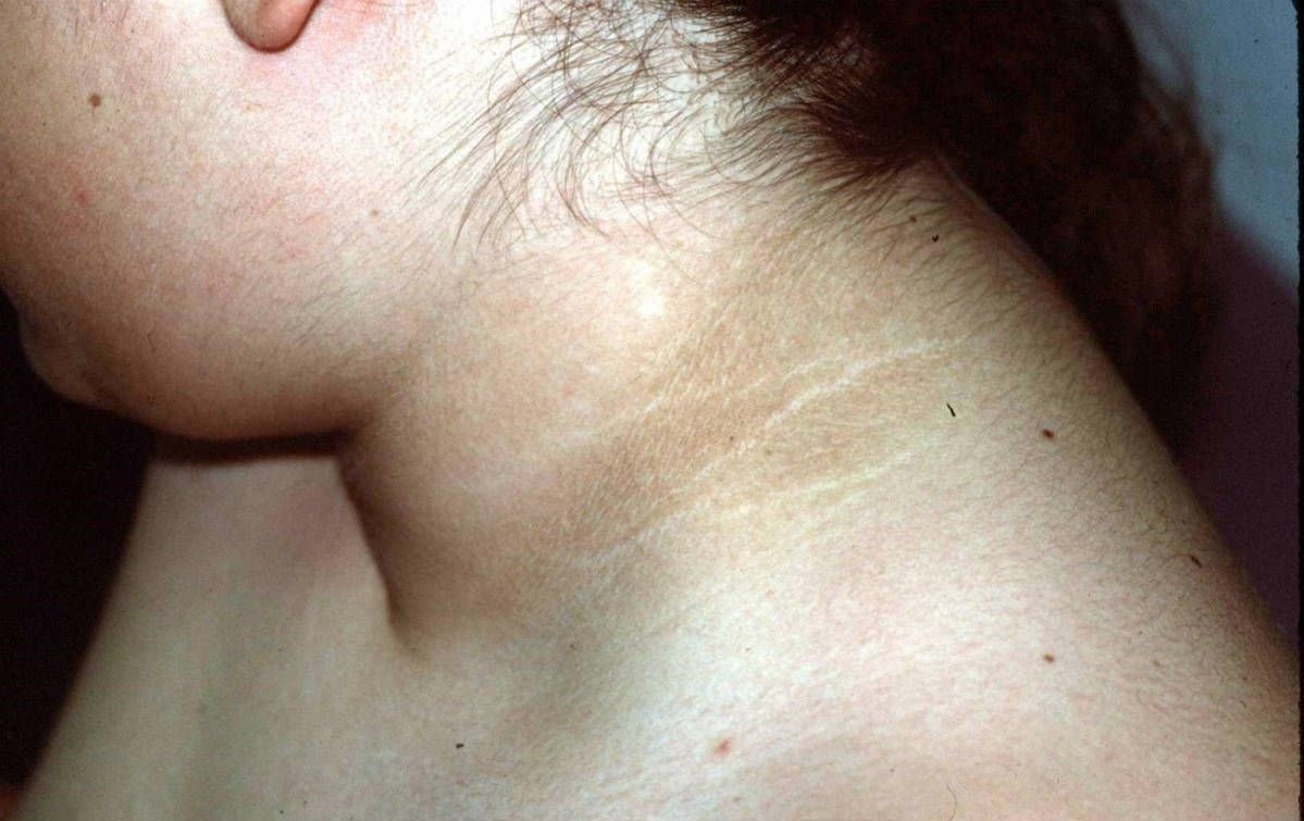 Tre 10 tuoi nang hon 90 kg va ganh nang beo phi o TP.HCM hinh anh