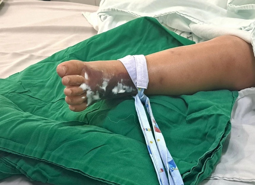 Ngay cang nhieu tre bi ngo doc duoc ghi nhan o TP.HCM hinh anh