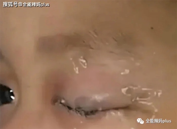 nho keo vao mat anh 1