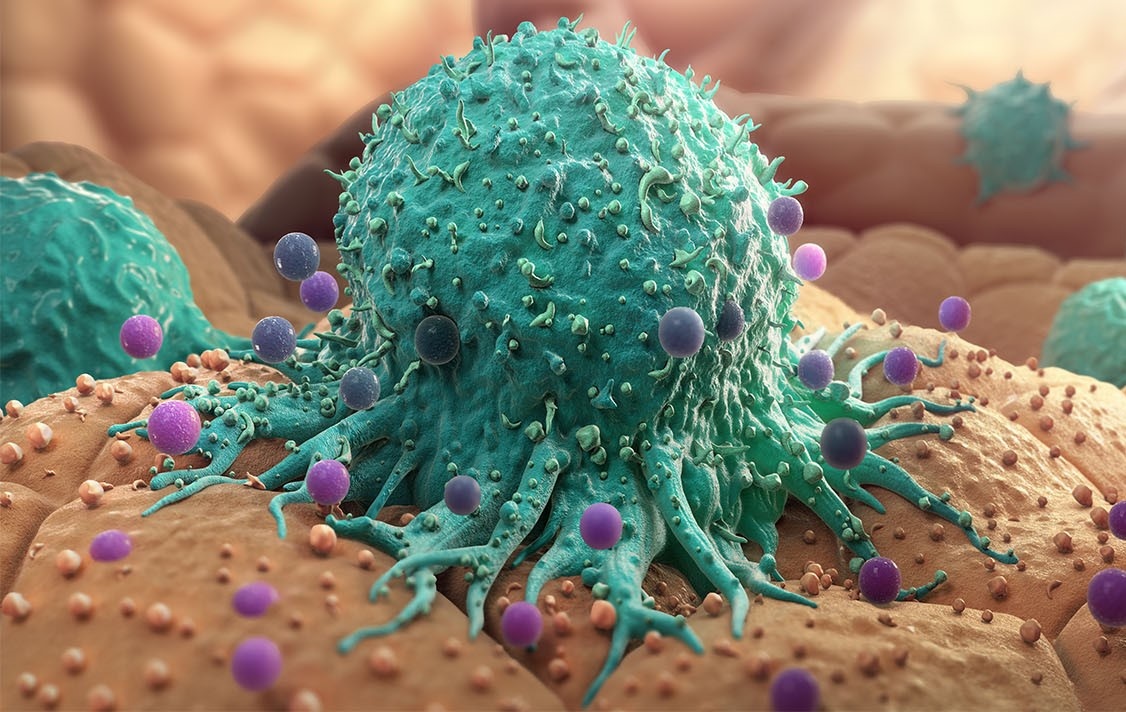 So nguoi mac ung thu o Viet Nam da tang gap 3 lan trong 30 nam hinh anh