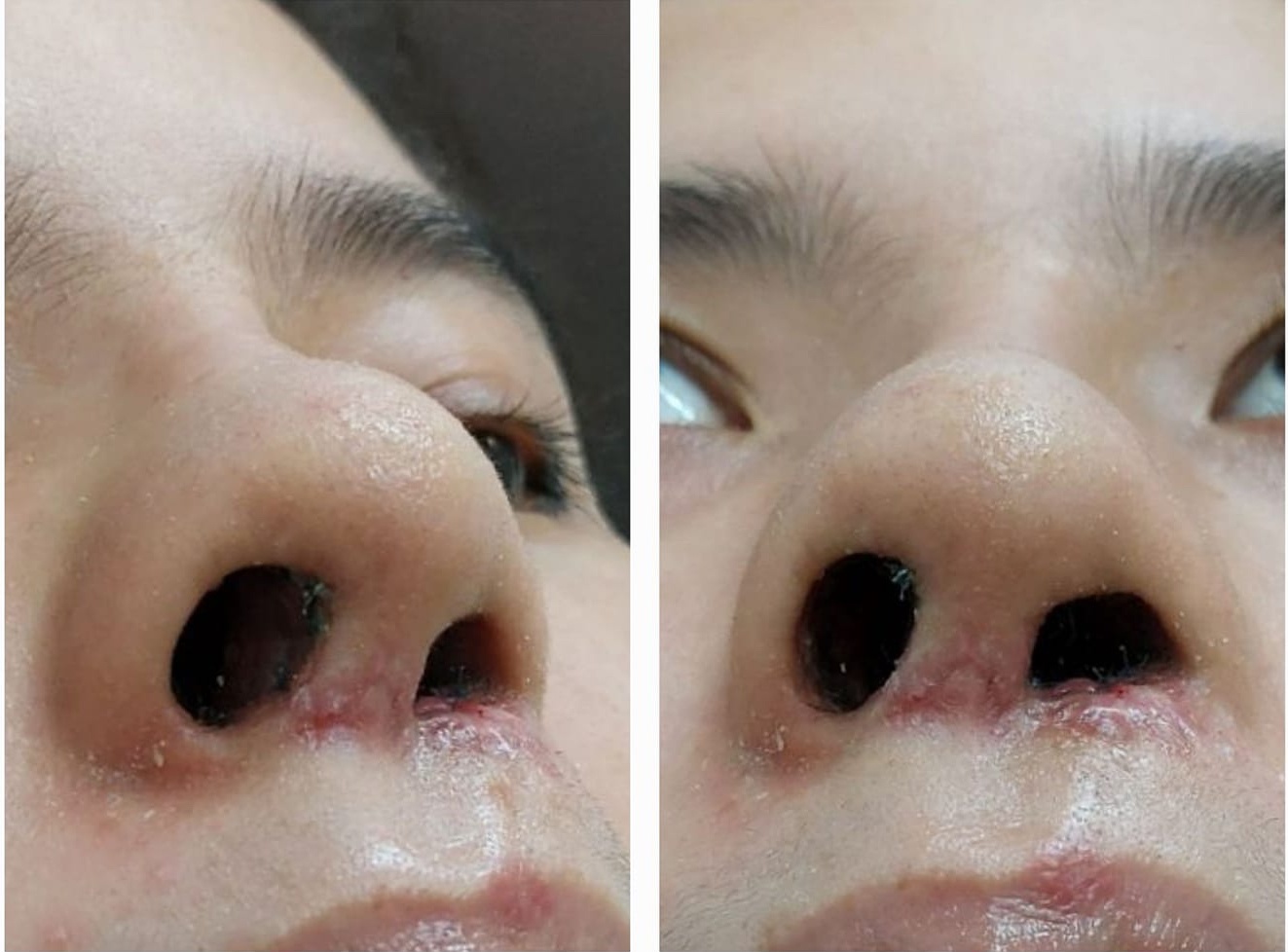 nang mui sun suon anh 2