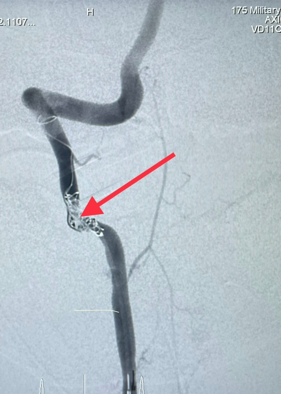 chan thuong hiem anh 1