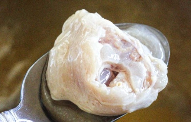 Tac ruot vi mieng gan bo hinh anh