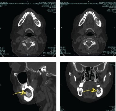 bien chung nho rang anh 1