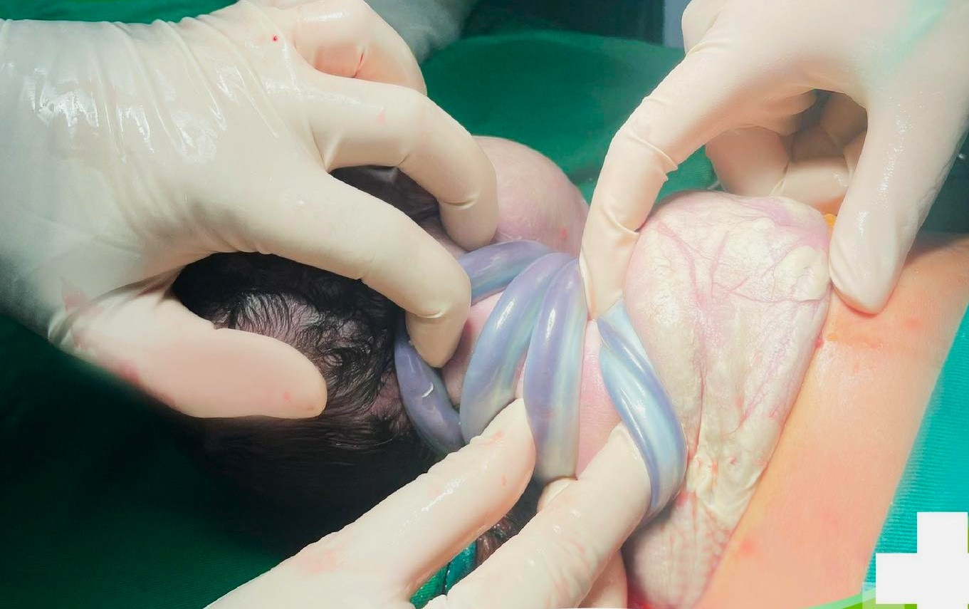 Be trai chao doi voi 4 vong day ron quan co hinh anh