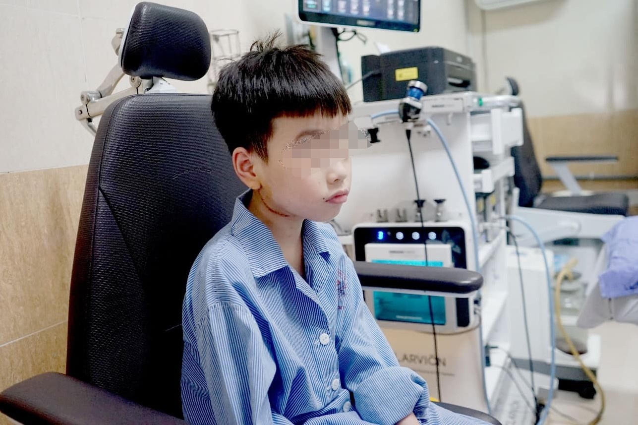 Bi u ham nhung suot 5 nam duoc chan doan sung amidan hinh anh