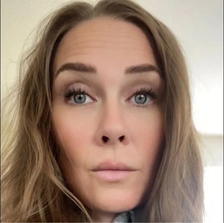 phau thuat tham my anh 2