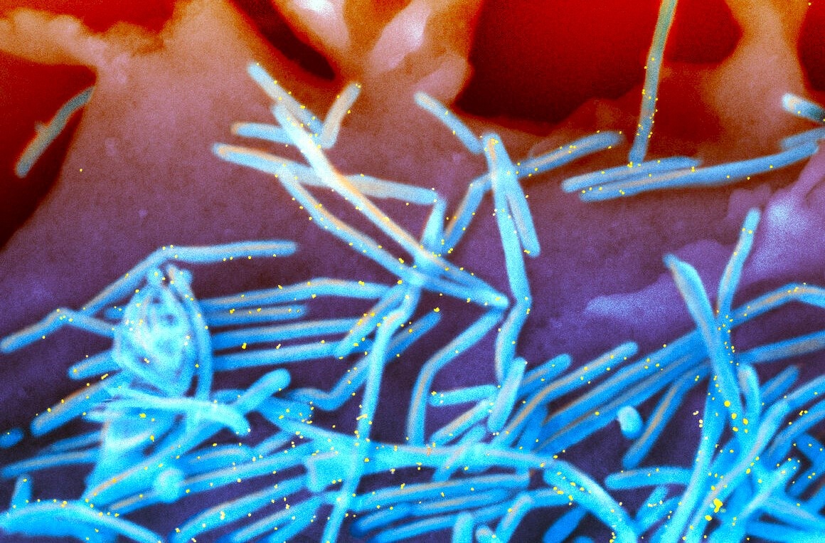 Trieu chung dien hinh khi nhiem virus RSV hinh anh