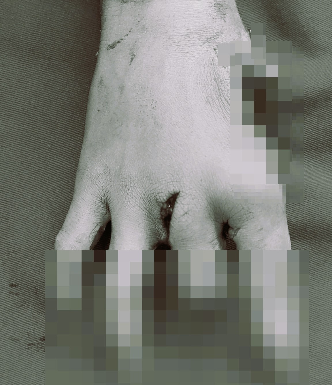 tai nan phao no anh 1