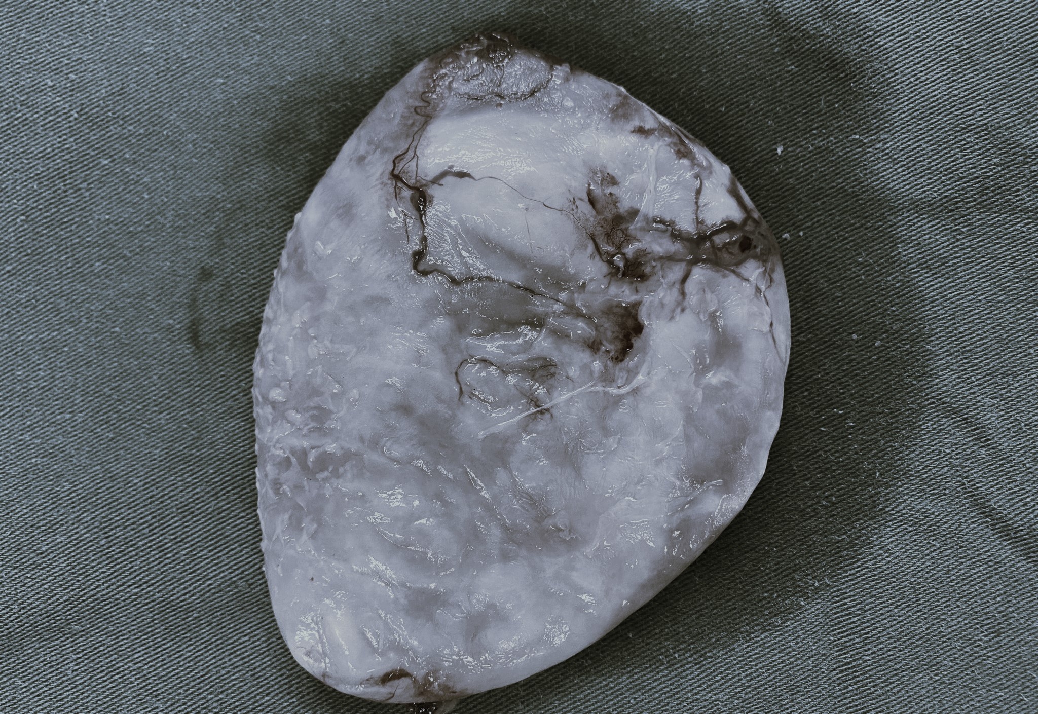 Nguoi dan ong bi san day cho vi mon an nguoi Viet ua chuong hinh anh