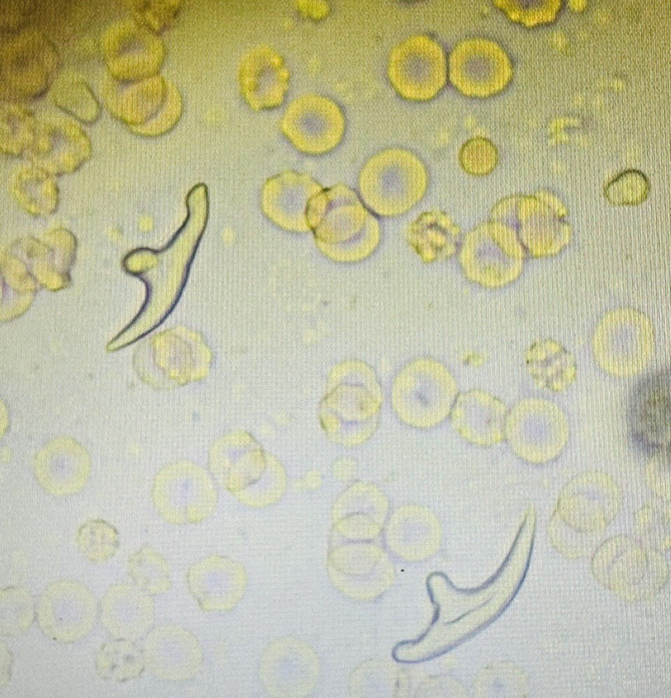 nhiem san day cho anh 1