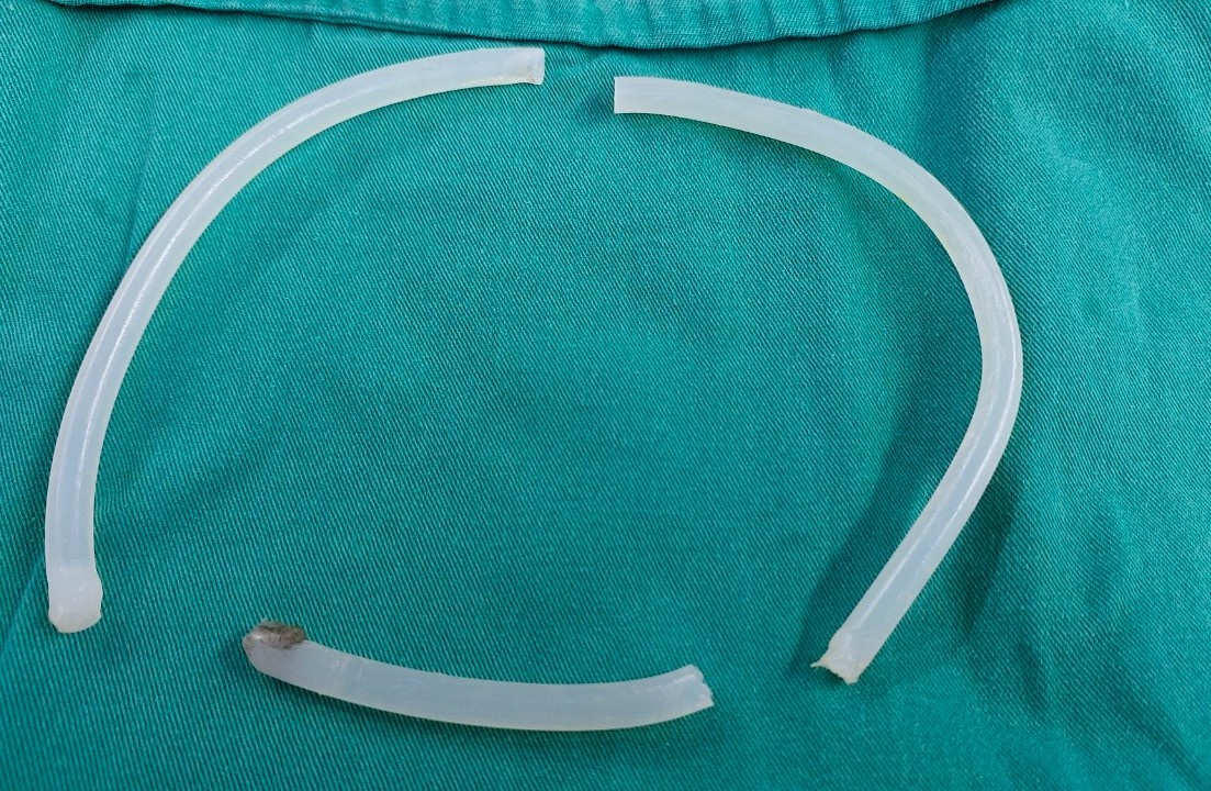 Cap cuu nguoi dan ong tu day 40 cm keo nen vao nieu dao hinh anh