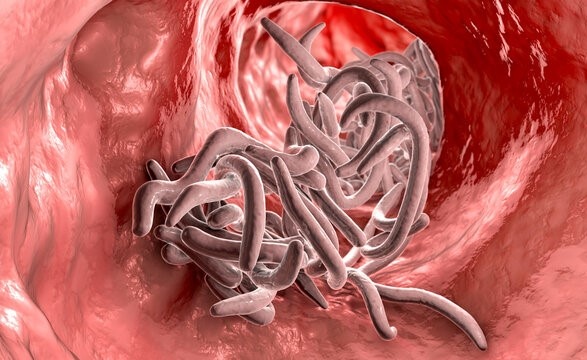 Nguoi dan ong bi ca o giun luc nhuc trong dai trang hinh anh